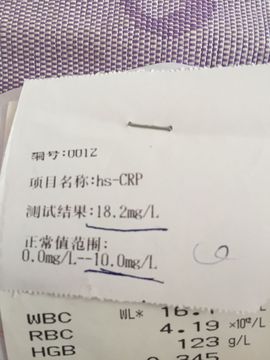 善丶静静的唱歌主播照片
