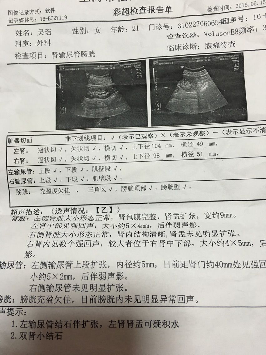椒盐小瑶瑶的主播照片