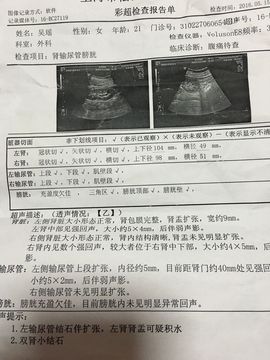 椒盐小瑶瑶主播照片