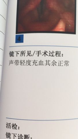 ╰❥℡冰雪每天40首主播照片