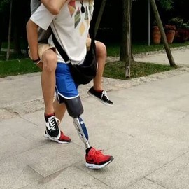 健达假肢主播照片