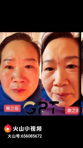 年轻，从遇见GPT开始😃😃