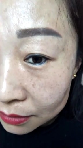 去皱逆龄，一次见效