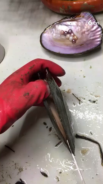 河蚌结石