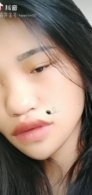 缝了好几十针都没流泪    可