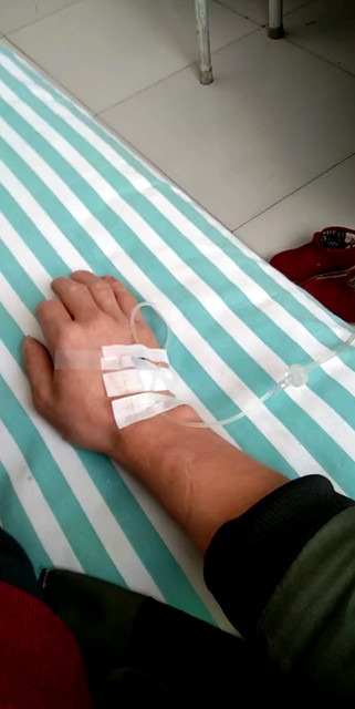 手都这样了😭😭😭