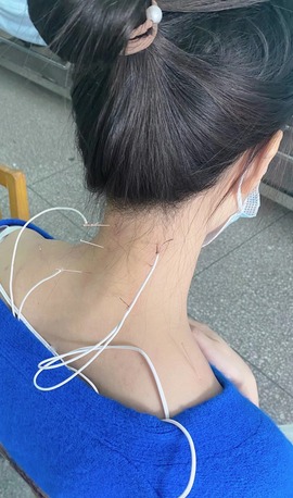 苏苏16号周年庆典的图片