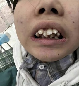 一三不整的图片