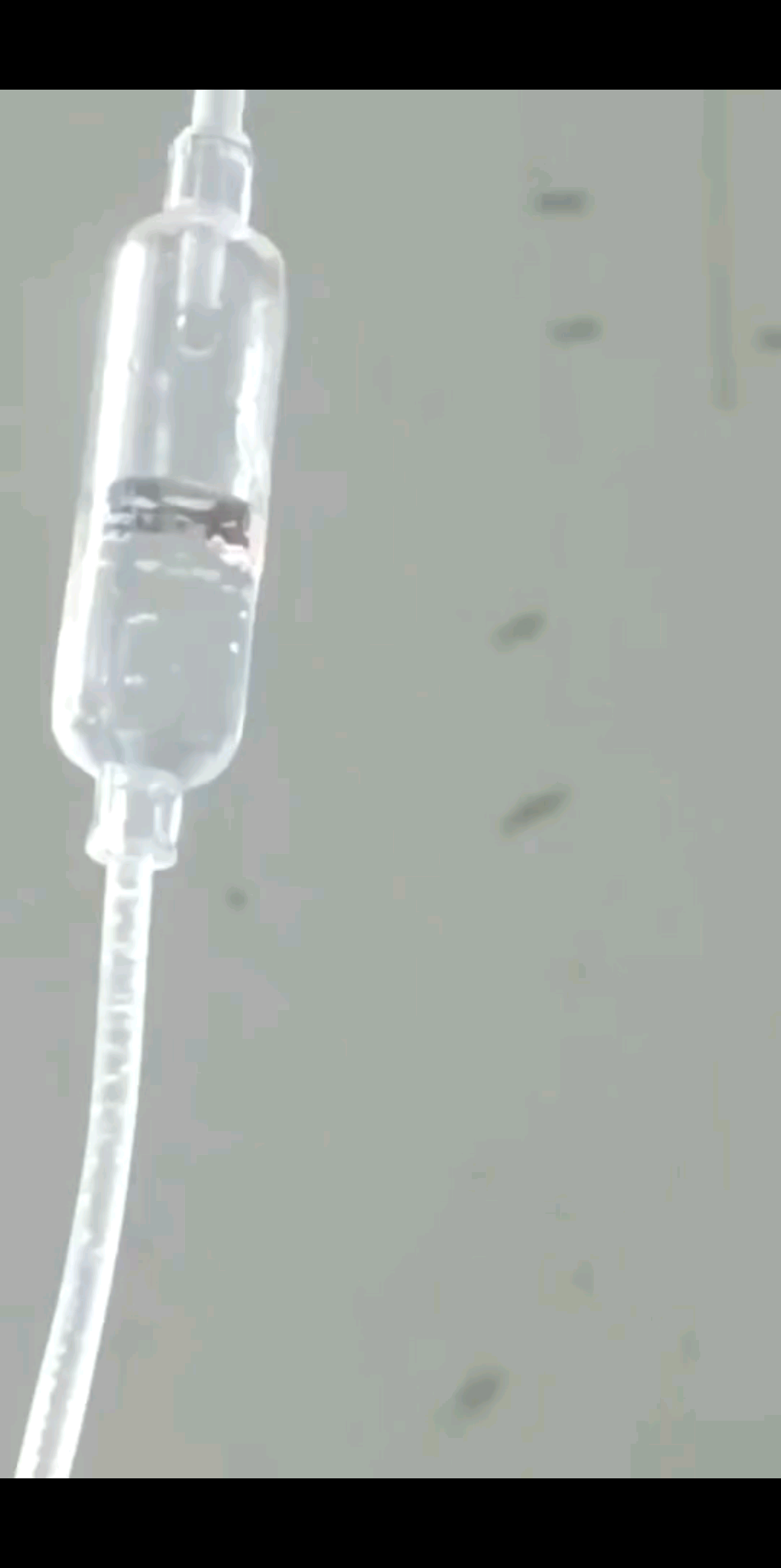 吃了两天药，以为可以
