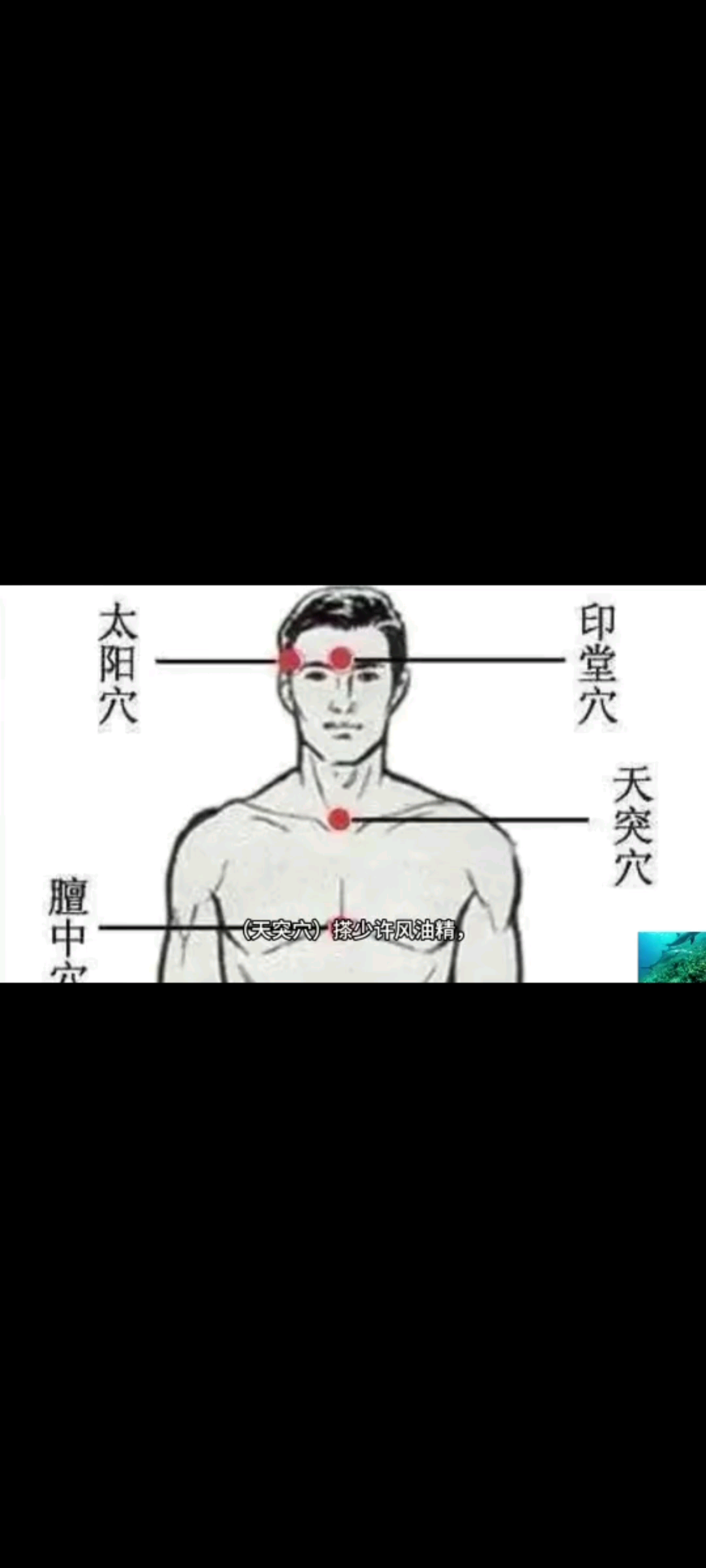 春夏必看！风油精秘笈