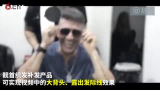头发少补发