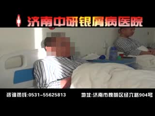 济南银屑病医院好吗