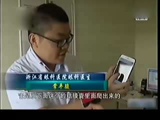女主人眼睛里爬出虫子 或与养的两条狗有关