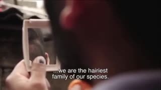 现实版 狼人 墨西哥一家族天生多毛