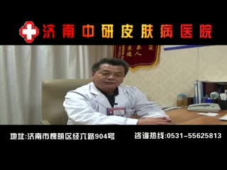 济南治疗青年脱发的医院