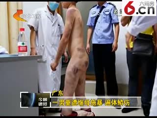 一男童遭继母施暴 遍体鳞伤